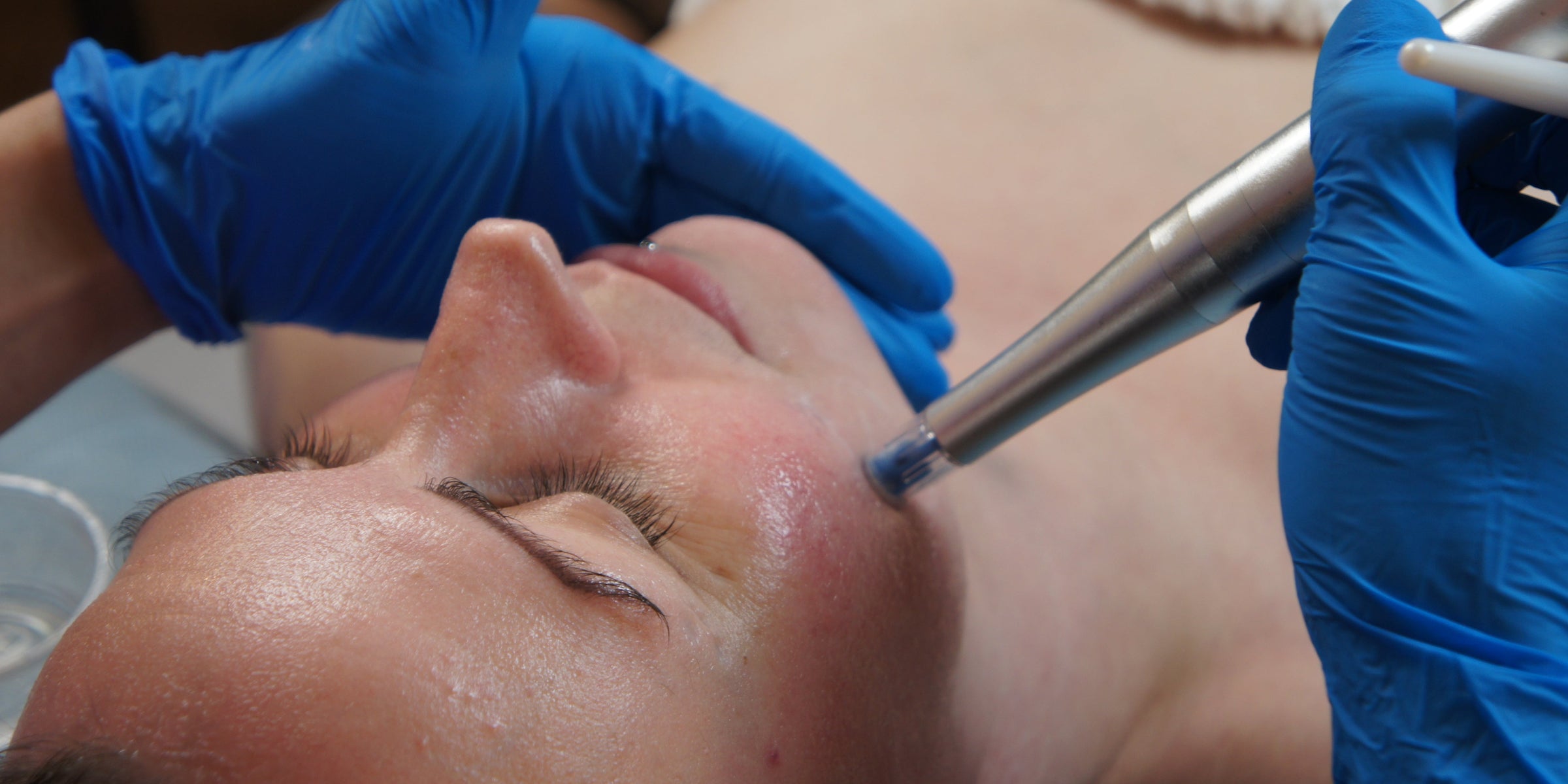 Advanced Facial Treatment