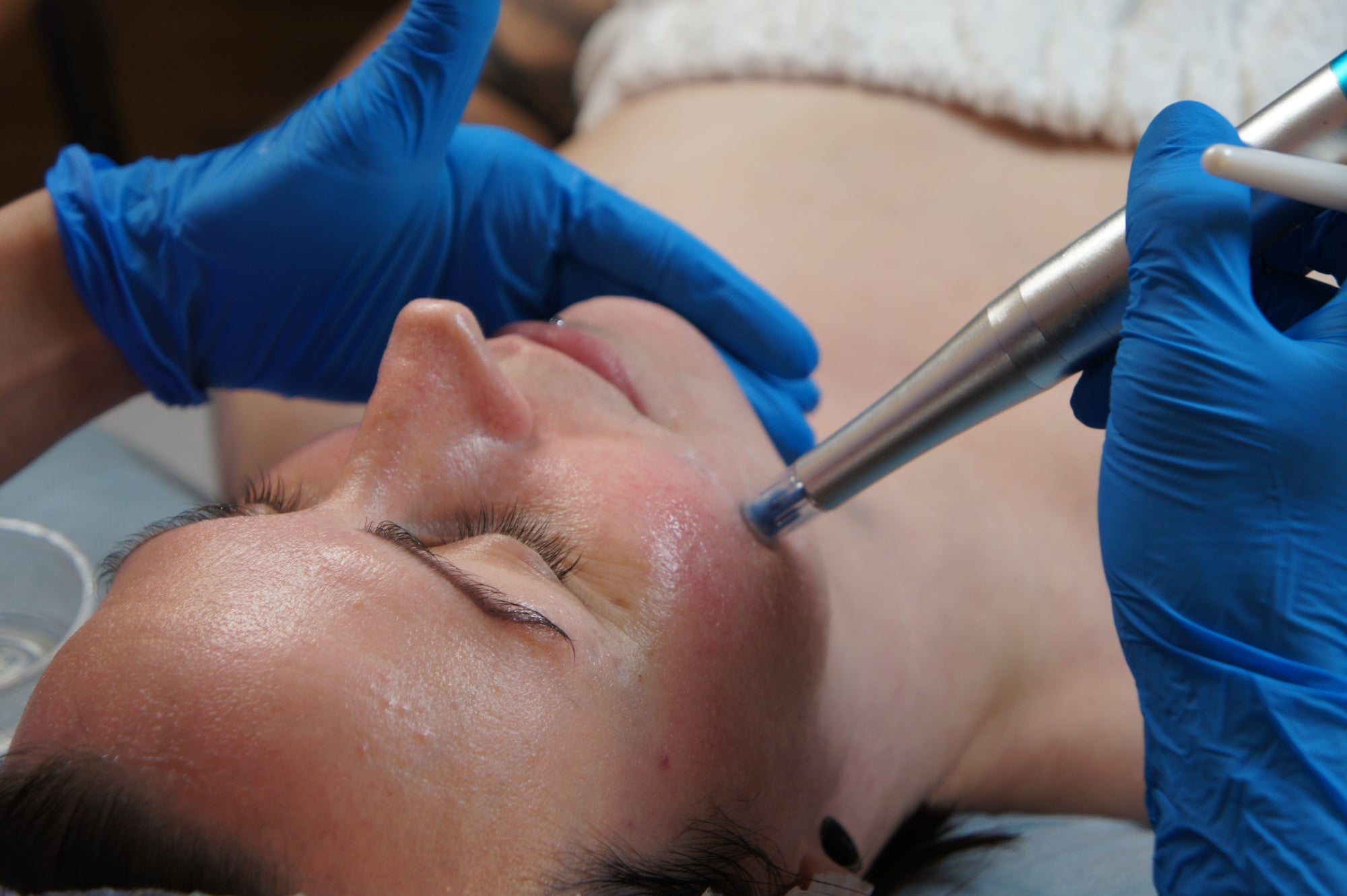 Nano Infusion & Deluxe HydraFacial